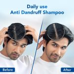 Scalpe Pro Daily Anti-Dandruff Shampoo | Removes Dandruff from Source | Helps with Itching, Irritation & Redness accompanying Dandruff | Scalpe Science | Climbazole & ZPTO Formulation | Strong & Smooth Hair | Daily Use | Dermatologically Tested Solution | For Women & Men | 200ml - Image 2