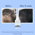 WishCare Hair Growth Serum Concentrate - 3% Redensyl, 4% Anagain, 2% Baicapil, Caffeine, Biotin & Rice Water - Advanced Hair Growth Serum for Hair Fall Control & Hair Growth 30ml - Image 4