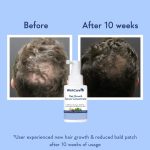 WishCare Hair Growth Serum Concentrate - 3% Redensyl, 4% Anagain, 2% Baicapil, Caffeine, Biotin & Rice Water - Advanced Hair Growth Serum for Hair Fall Control & Hair Growth 30ml - Image 3