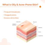 The Derma Co 1% Hyaluronic Sunscreen Oil-Free Gel SPF 50 PA++++ | For Oily, Acne-Prone Skin | Lightweight Texture | No White Cast | UVA/UVB, Broad Spectrum Protection & Blue Light Protection | Non- Comedogenic | Clinically Tested - (In -Vivo) | Tan Protection | Photostable | For Men & Women | 50 g - Image 5