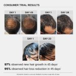Bare Anatomy Advanced Hair Growth Serum | 3% Redensyl + 4% Anagain + 3% Baicapil + 1% Capilia Longa, Rosemary, Biotin & Rice Extract | Thick Density | Hair growth & Hair fall control serum for Women & Men | 30mL - Image 6