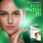 Urban Yog Acne Pimple Patch for Face (72 dots) | Waterproof Patches for Active Acne | Absorbs Pimple Overnight and Reduces Excess Oil | Facial Patches with 100% Hydrocolloid - Image 2