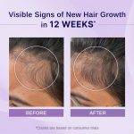 Bare Anatomy Nature x Science Rosemary Hibiscus Hair Growth Oil for Women & Men | Promotes New Hair Growth & Strengthens Hair | Nourishes Scalp & Controls Hair Fall | Suitable for All Hair Types-100ml - Image 2