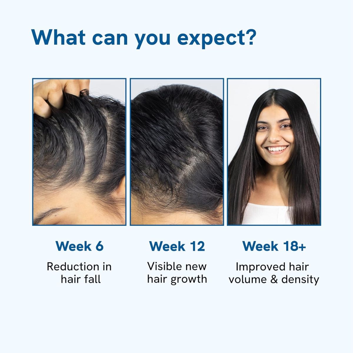 Be Bodywise Rosemary Hair Growth Serum (Roll On) | 3% Redensyl & 2% Anagain | Hair fall control serum for Women & Men | Promotes Hair Growth & Stimulates Hair Follicles | For All Hair Types | 25ml - Image 6
