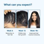 Be Bodywise Rosemary Hair Growth Serum (Roll On) | 3% Redensyl & 2% Anagain | Hair fall control serum for Women & Men | Promotes Hair Growth & Stimulates Hair Follicles | For All Hair Types | 25ml - Image 6