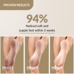Fixderma Foobetik Cream, Foot cream, Foot Care For Diabetic, For Dry & Cracked Feet, Moisturizes & Soothes Feet, Heel Repair, For Calloused, or Chapped Skin, Paraben Free - 50g - Image 4