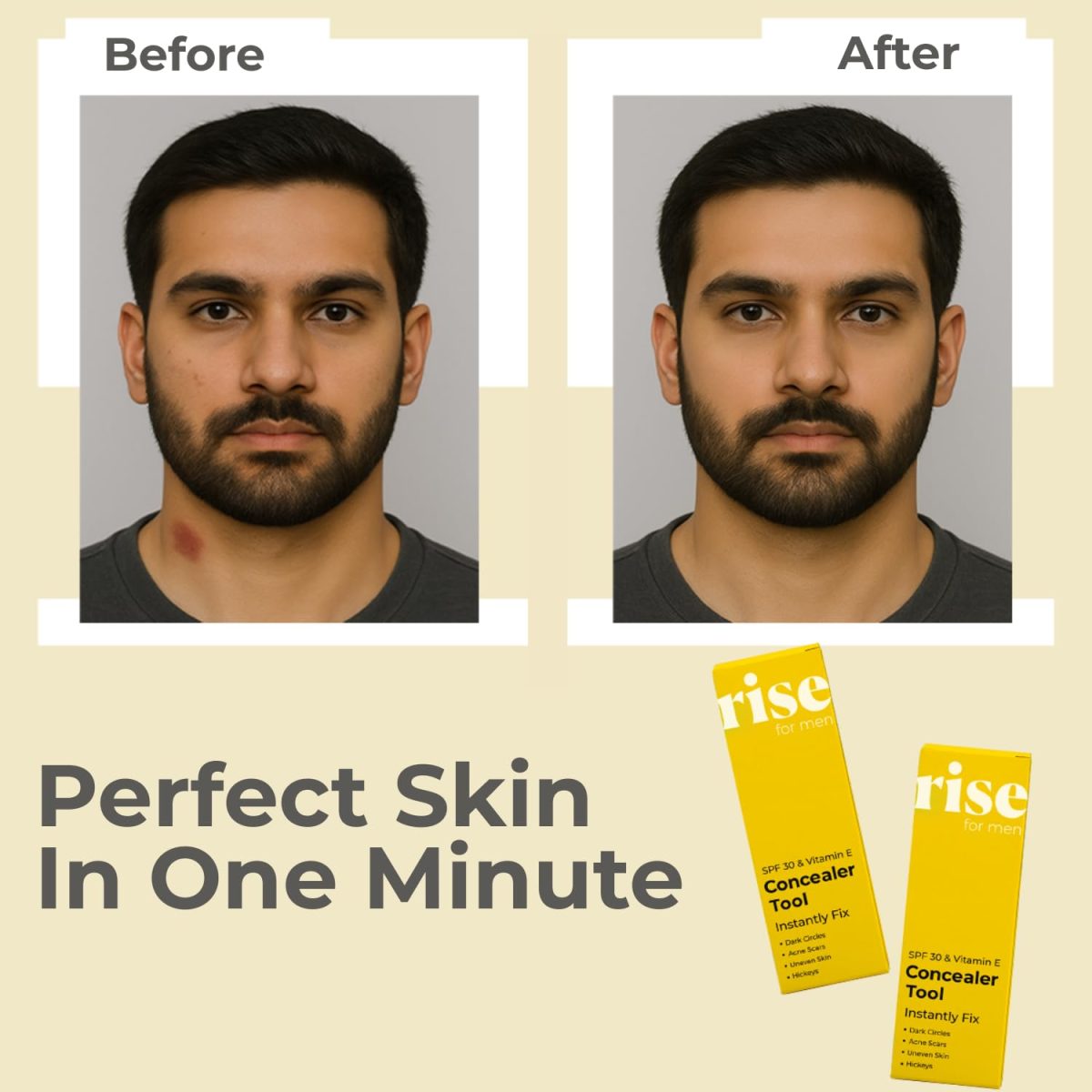 Rise for Men Concealer Tool | Covers Spots, Dark Circles, Acne Scars, & Hickeys Instantly | SPF 30 & Vitamin E | Available in 4 Shades (Light) - Image 2