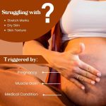 POKONUT - nurture with love Ayurvedic Stretch Mark Cream | Improves Appearance Of Fresh And Mature Stretch Marks | Infused With Hyaluronic Acid & Rosehip Oil | Natural And Cruelty-Free | 50 Gm - Image 3