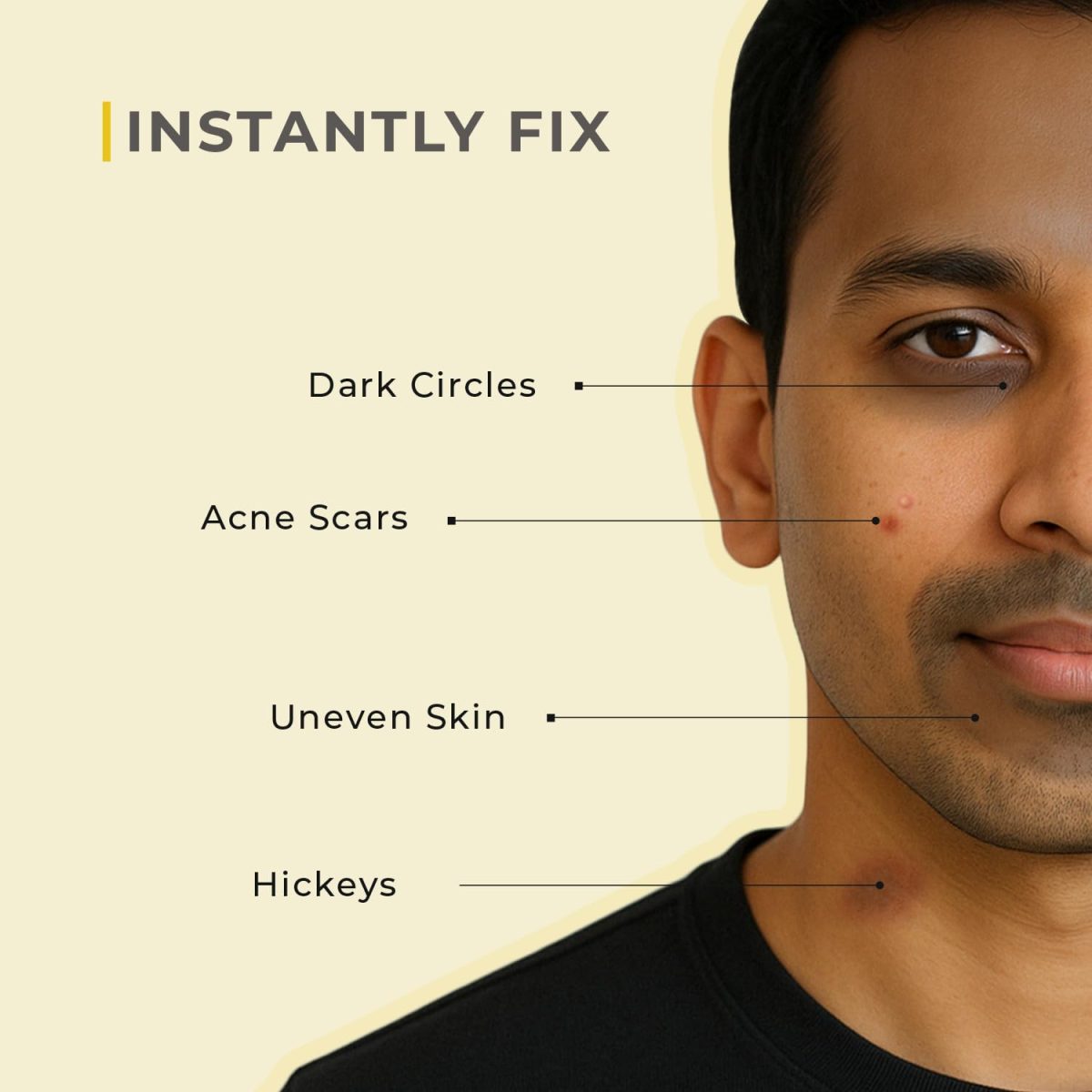 Rise for Men Concealer Tool | Covers Spots, Dark Circles, Acne Scars, & Hickeys Instantly | SPF 30 & Vitamin E | Available in 4 Shades (Light) - Image 4