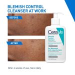 Cerave Blemish Control Cleanser with 2% Salicylic Acid & Niacinamide for Acne Prone Skin, Controls Acne & Spots, Unclog Pores & Reduces Blemishes, 236ml - Image 5