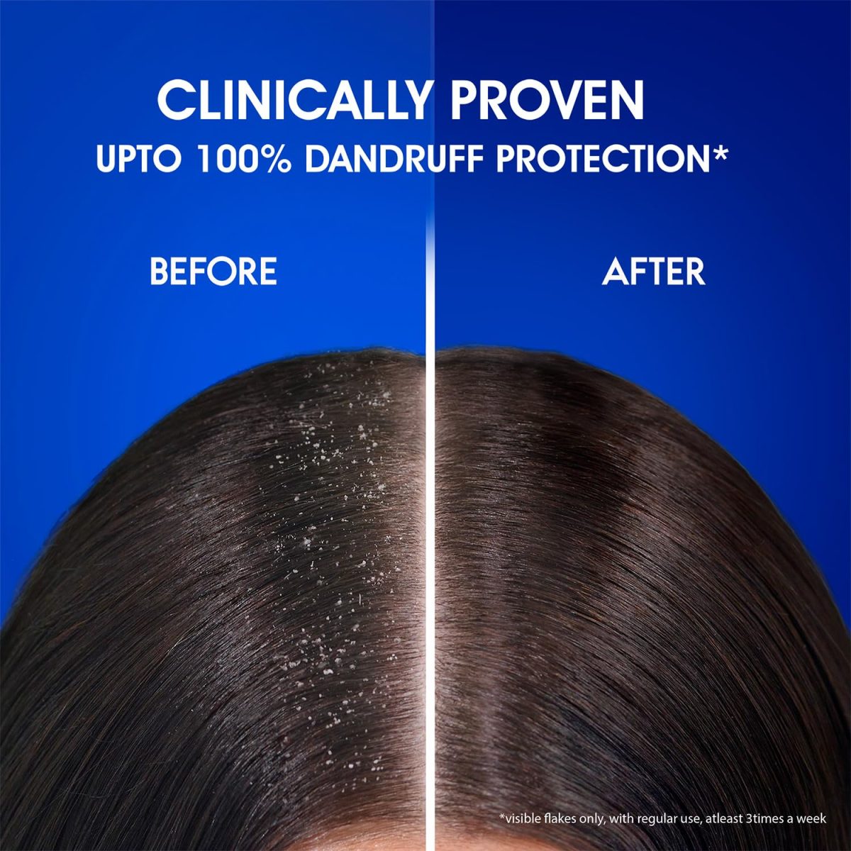 Head & Shoulders , Anti Dandruff Shampoo, Anti Hairfall, 340 ML - Image 8