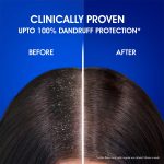 Head & Shoulders , Anti Dandruff Shampoo, Anti Hairfall, 340 ML - Image 8