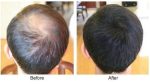 Tombull Cabok Hair building fiber is absolutely natural & unnoticeable Black 25gm - Image 5