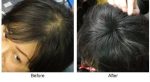 Tombull Cabok Hair building fiber is absolutely natural & unnoticeable Black 25gm - Image 4