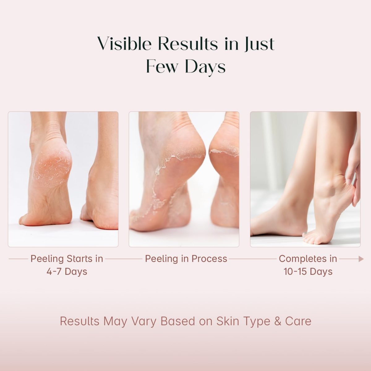 SeoulSkin Glycolic Acid Foot Peeling Mask (1 Pair), Korean Peeling & Exfoliating | Deep Exfoliation with Glycolic Acid, Removes Dead Skin, Cruelty-Free, Foot Peel Off Mask - Image 4