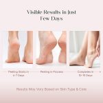 SeoulSkin Glycolic Acid Foot Peeling Mask (1 Pair), Korean Peeling & Exfoliating | Deep Exfoliation with Glycolic Acid, Removes Dead Skin, Cruelty-Free, Foot Peel Off Mask - Image 4