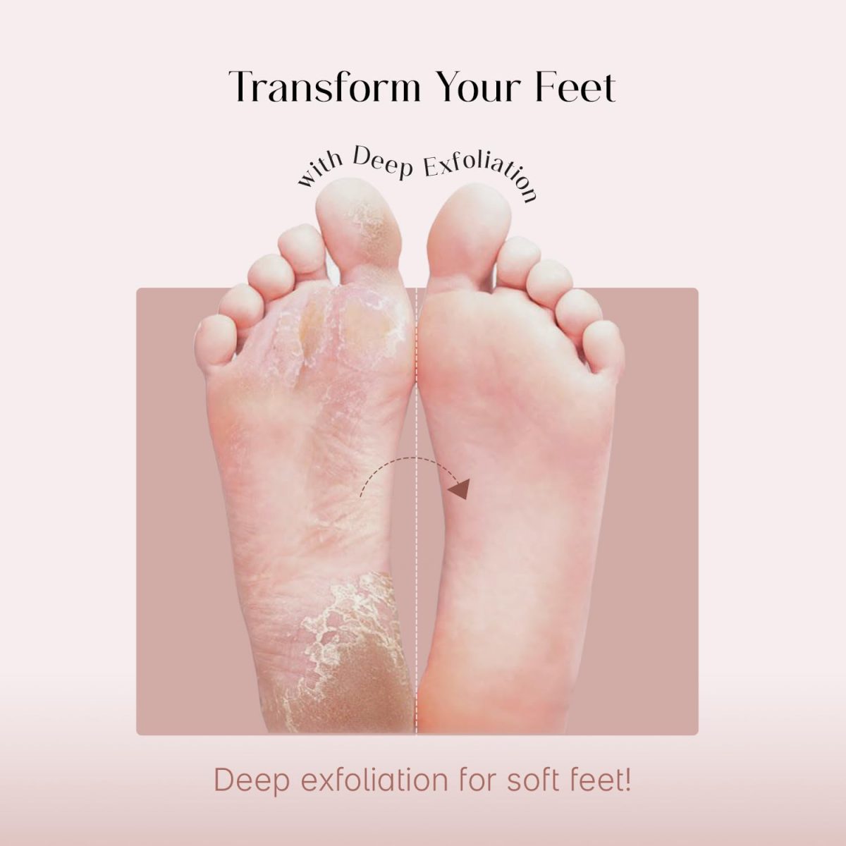 SeoulSkin Glycolic Acid Foot Peeling Mask (1 Pair), Korean Peeling & Exfoliating | Deep Exfoliation with Glycolic Acid, Removes Dead Skin, Cruelty-Free, Foot Peel Off Mask - Image 3