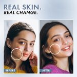 ThriveCo 2% Salicylic Acid Serum for Face | Anti-Acne & Blackhead Removal | Oil Control, Blemish Care & Exfoliating Serum | For Oily & Acne-Prone Skin | 30ml - Image 5