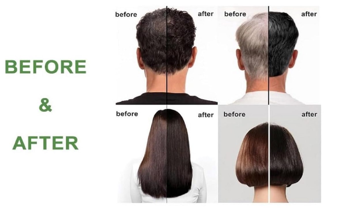 Fruit Vinegar Hair Dye Color for Both Men, Women, Natural & Ammonia Free Color Dye (Black, A/B 100 Ml) (Natural, 1) - Image 4