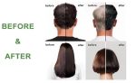 Fruit Vinegar Hair Dye Color for Both Men, Women, Natural & Ammonia Free Color Dye (Black, A/B 100 Ml) (Natural, 1) - Image 4