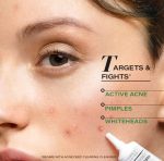 Novology Acne Spot Corrector Gel | For Active Acne, Pimples, Whiteheads | 30g - Image 4