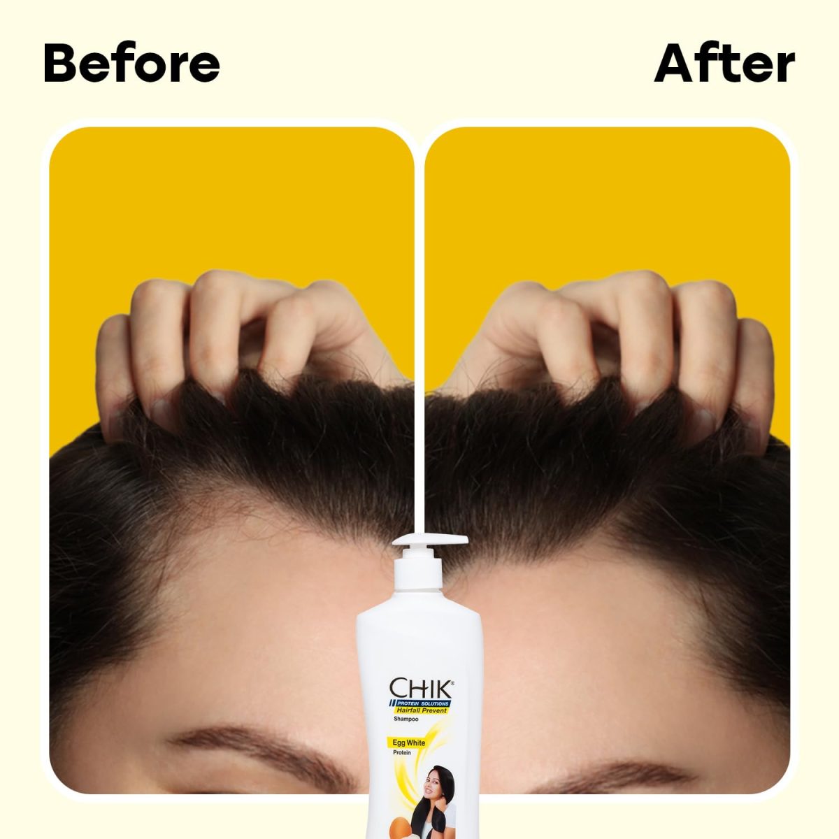 Chik Protein Solution Hairfall Prevent Shampoo, With Goodness Of Egg White, For Thick And Healthier Hair (340ml) - Image 5