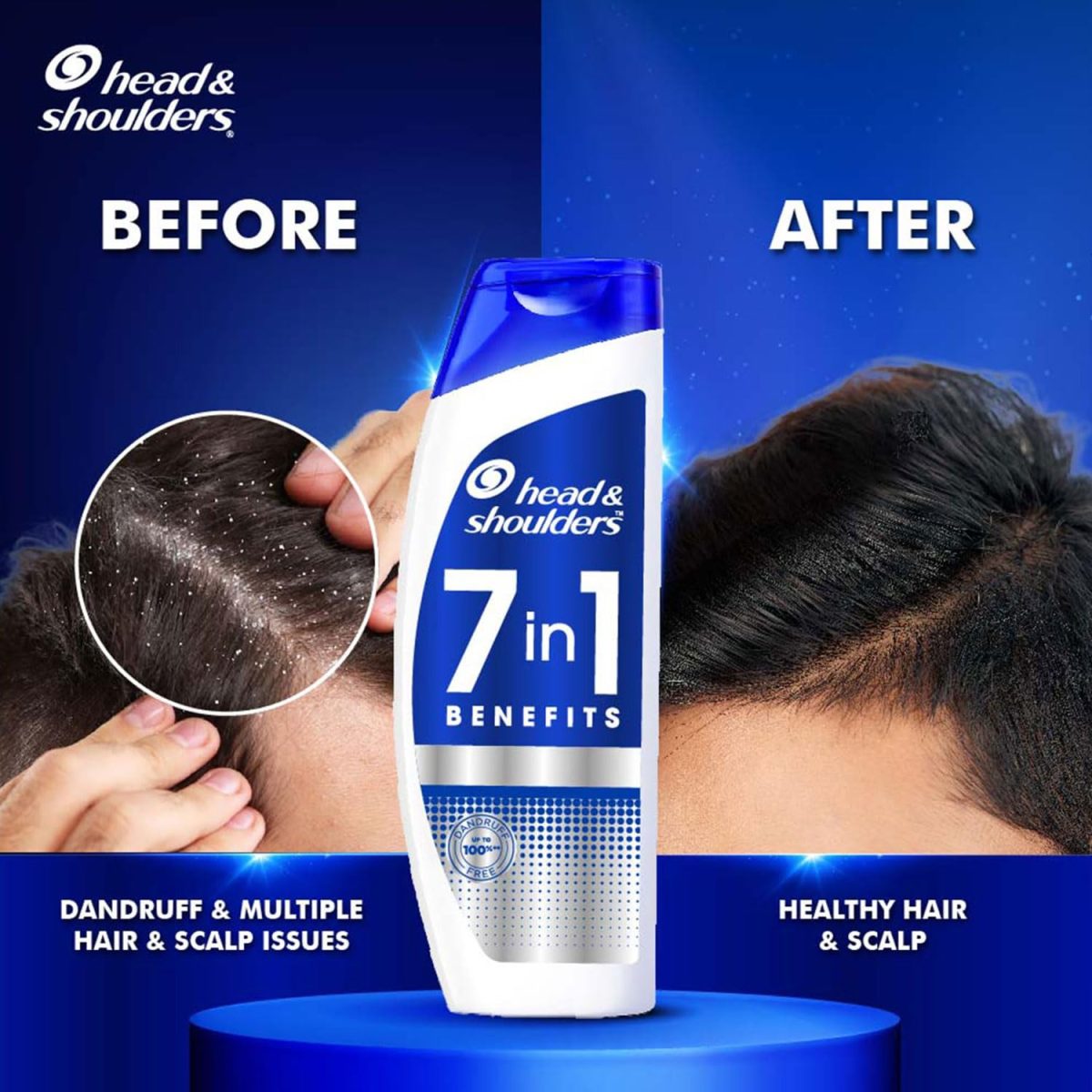 Head & Shoulders 7in1 Anti-dandruff Shampoo | Multi-action formula | Complete Solution for unhealthy scalp | 7 benefits for Men and Women, 650ml - Image 8