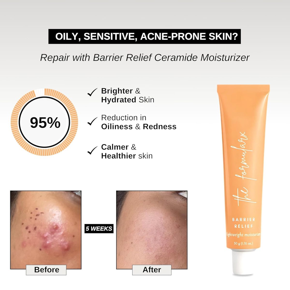 The Formularx Barrier Relief Ceramide Lightweight Moisturizer With Niacinamide & Hyaluronic Acid | For Oily, Combination, Dehydrated, Acne Prone, Sensitive Skin | 50 Gram - Image 3