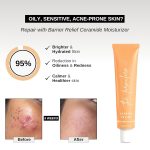The Formularx Barrier Relief Ceramide Lightweight Moisturizer With Niacinamide & Hyaluronic Acid | For Oily, Combination, Dehydrated, Acne Prone, Sensitive Skin | 50 Gram - Image 3