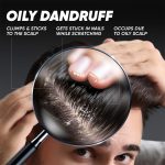 Head & Shoulders Deep Cleanse Anti Dandruff Shampoo with Oxygenated Charcoal, Fights Oily & Sticky Dandruff, Upto 100% Dandruff Protection, 72 ml - Image 4