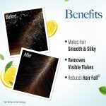Kesh King Ayurvedic Anti-Dandruff Shampoo | Reduces hair fall | Soothes itchy scalp | No Paraben & No Silicon | 21 natural ingredients | Enriched with curd, lemon & neem | 600 ml - Image 5