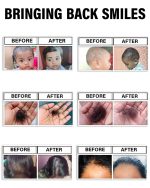 PIMPOM PAATI HAIR OIL 100ml | Hair Oil For Men, Women & Kids | For Hair Growth | Hair Fall Control | Chemical Free - Image 6