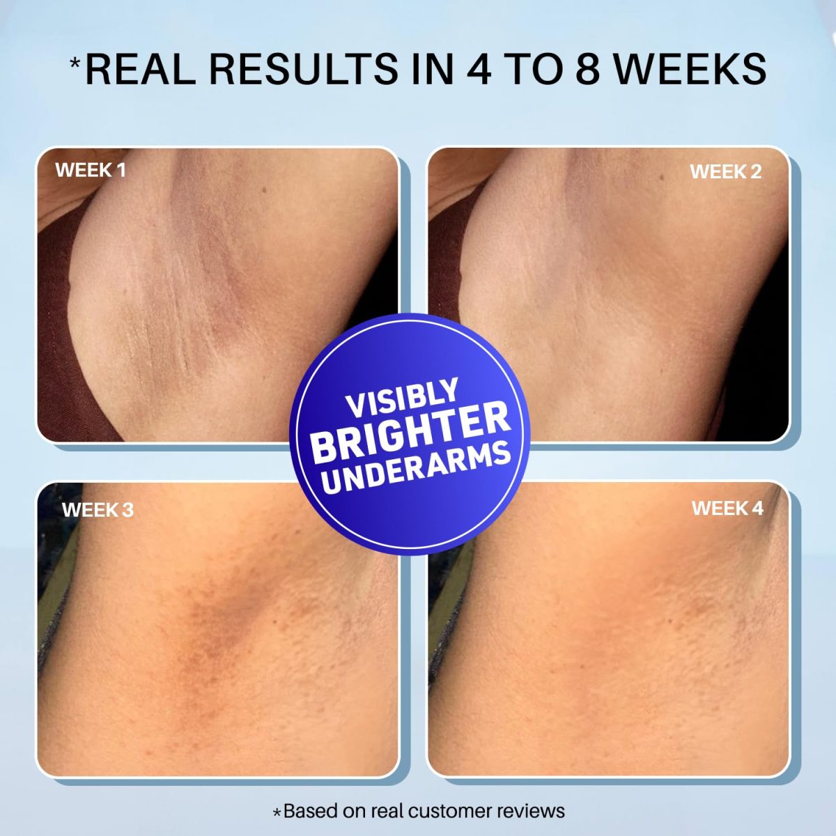 DermDoc 5% Glycolic Acid Underarm Brightening Spray Treatment (100 Ml)|Multipurpose Exfoliating Toner For Dark Spots On Face & Body|Helps With Dark Neck & Knees,Strawberry Legs With 2% Salicylic Acid - Image 3