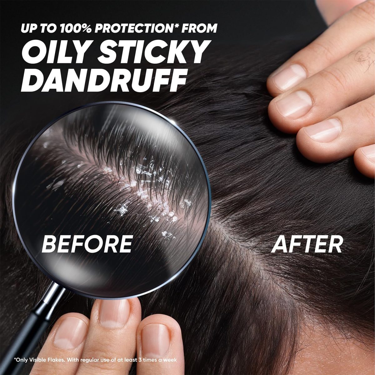Head & Shoulders Deep Cleanse Anti Dandruff Shampoo with Oxygenated Charcoal, Fights Oily & Sticky Dandruff, Upto 100% Dandruff Protection, 72 ml - Image 6
