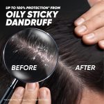 Head & Shoulders Deep Cleanse Anti Dandruff Shampoo with Oxygenated Charcoal, Fights Oily & Sticky Dandruff, Upto 100% Dandruff Protection, 72 ml - Image 6