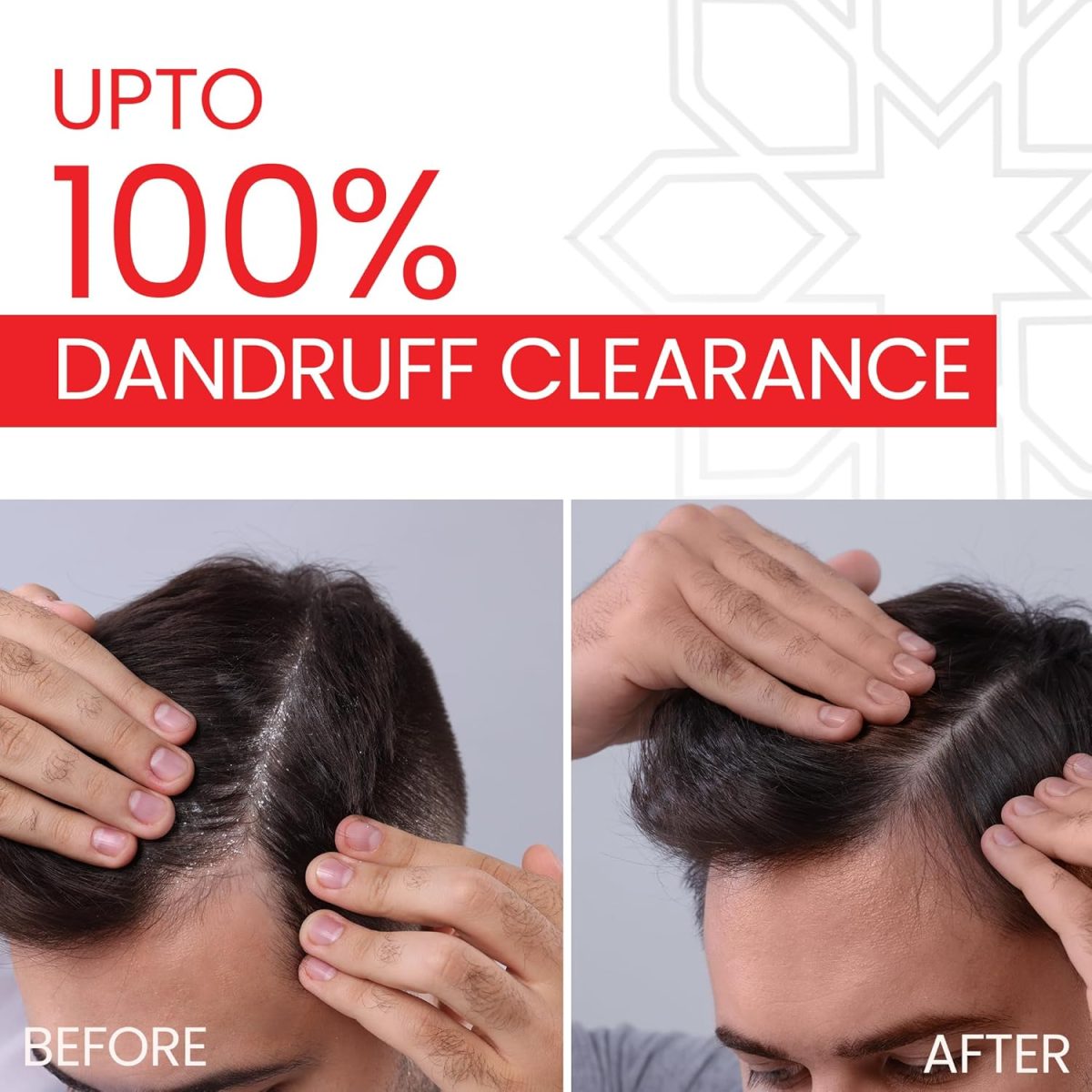 LUPIZOL-ZS Anti Dandruff Shampoo, Reduces Dandruff Upto 100% and Scalp Irritation, Strengthens and Softens Hair, With Luliconazole, Dermatologically Tested, All Hair Types, For Men and Women, 100ml. - Image 7