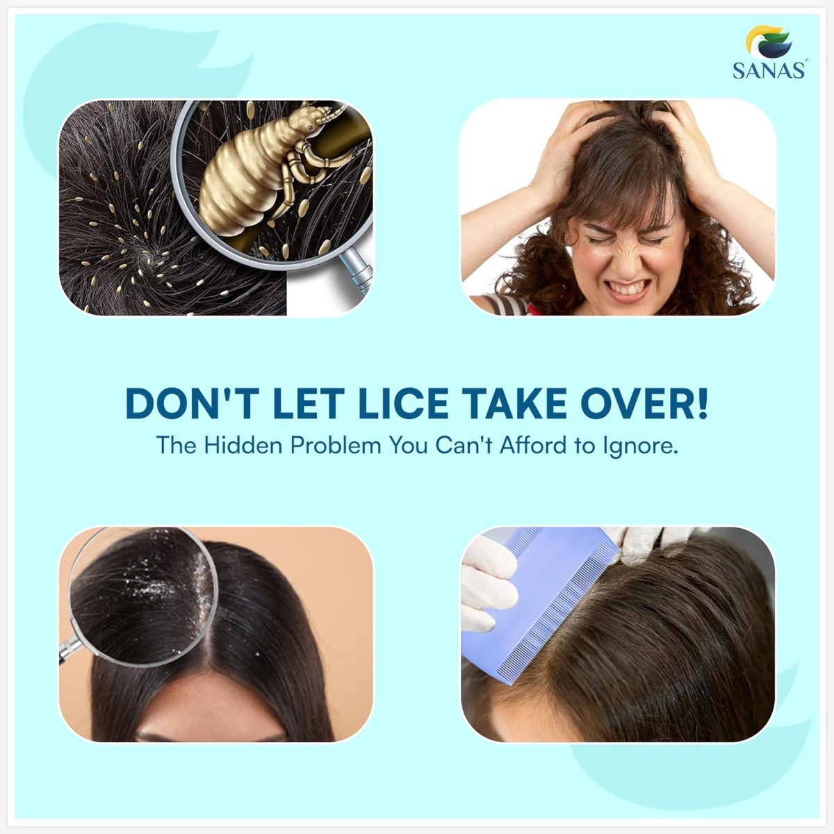Sanas Lice And Nits Removal Comb Lice Comb 3Pcs Lice Removal Machine For Women And Kids Dandruff Remover Eggs Removing Comb For Kids Nits R 3Pcs (Multicolour) - Image 6