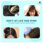 Sanas Lice And Nits Removal Comb Lice Comb 3Pcs Lice Removal Machine For Women And Kids Dandruff Remover Eggs Removing Comb For Kids Nits R 3Pcs (Multicolour) - Image 6
